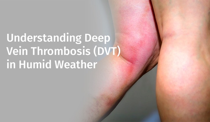 Understanding Deep Vein Thrombosis (DVT) in Humid Weather